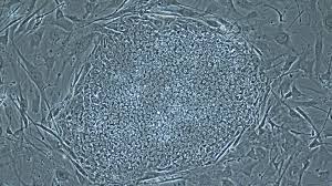 The company develops different cell types from its stem cells that may result in therapeutic products. Its Stem Cell Therapies A Bust Pioneering Company Shuts Down