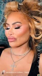 The Silva Twins (Darcey & Stacey) frequently appear in magazines