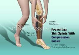Preventing Shin Splints With Compression Socks