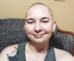 Tired of Shaving, Wishing for Alopecia