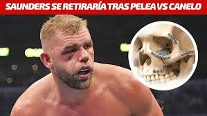Billy Joe Saunders considera el retiro tras las lesiones sufridas ante  Canelo