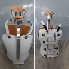 Milwaukee Brace With A Boston Jacket Mycaremedical Milwaukee Brace Orthopedic Brace Braces