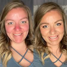 I wanted to share this reel that my teammate, Melissa Willoughby, created.  It's such a great explanation of how bronzer, Tanlines, can offer rosacea  coverage.