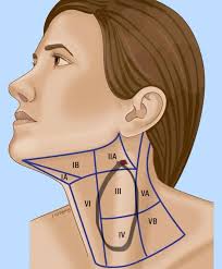 Dry eyes and mouth due to fibromyalgia