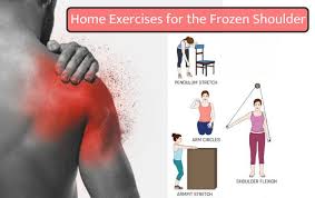 Image result for Frozen Shoulder