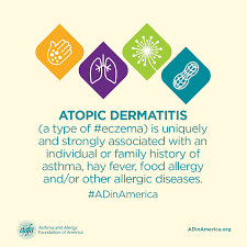 Asthma And Other Conditions Can Raise Your Chances Of Having Atopic Dermatitis Atopic Dermatitis Dermatitis Asthma