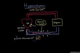 Hypovolemic Shock Video Shock Khan Academy