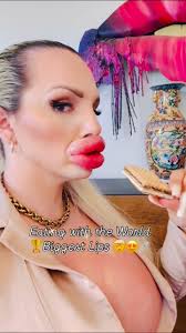 LE PICARON LAS ABEJAS 🐝 🥶