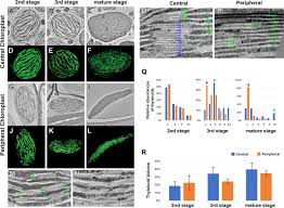 However, with microscopes of various types, plant cells can be readily viewed and studied. Electron Tomography Analysis Of Thylakoid Assembly And Fission In Chloroplasts Of A Single Cell C4 Plant Bienertia Sinuspersici Scientific Reports