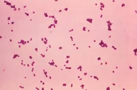 Salmonella typhosa (typhoid 22 fever). Details Public Health Image Library Phil