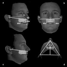 Image result for Occlusal