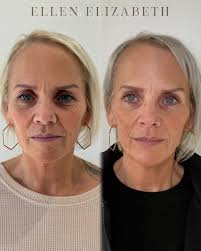 Ellen Elizabeth Aesthetics...