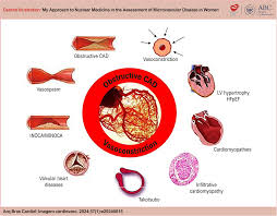 My Approach to Nuclear Medicine in the Assessment of Microvascular Disease  in Women - ABC Imaging