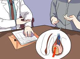 Is simple if you are trained to do it. 4 Ways To Treat A Cyst Wikihow