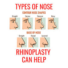 The straight nose or greek nose is often considered the most attractive of all types of noses. What Types Of Nose Shape Can Rhinoplasty Help Nyc Plastic Surgeon