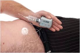 Image result for Apomorphine