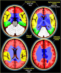 Image result for Neurologic Lesion Localization