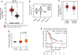 PHF13 epigenetically activates TGFβ driven epithelial to mesenchymal  transition | Cell Death & Disease