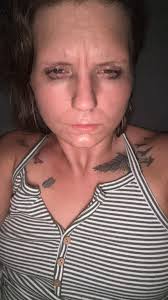 Excessive yawning and cold sweats at work