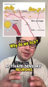 Andi Marie Tillman Why do I itch? What causes itching? While we still...