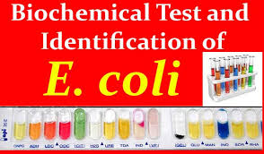Biochemical Test And Identification Of E Coli