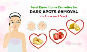 We will share few home remedies for dark spots in this article that will also help you to achieve clear skin. 21 Must Know Home Remedies For Dark Spots Removal On Face And Neck