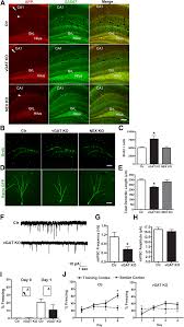 And is easily available at your fingertips. Selective Deletion Of App In Gabaergic Interneuron Impairs Download Scientific Diagram