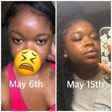 Organic Turmeric Soap Bar