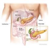 Image result for what type of treatment is done if a tumor in the neck of the pancreas is beign