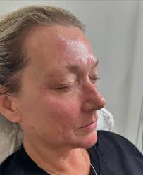 NOW FULL PAYMENTS PLEASE* Hi everyone! A post close to my heart! I'm  raffling off a Million Dollar Facial (worth £125) to help raise funds for  my Nephew William's and Niece Georgia's