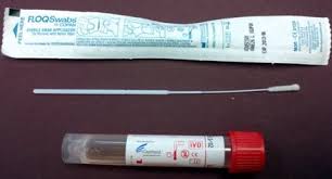 Influenza A B Pcr Mercyone Laboratory Test Catalog