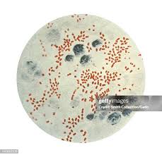 Image result for yersinia fotos