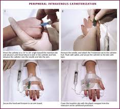 Image result for Difficult Intravenous Access in Children