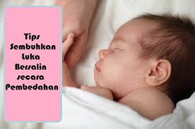 Berkat sifat yang antiinflamasi, ramuan daun bidara bisa membantu untuk mempercepat selain itu, daun dari tanaman bidara juga dapat menghilangkan bekas luka. Cuties Mama 7 Petua Untuk Sembuhkan Luka Selepas Bersalin Secara Pembedahan Bermacam Macam Tips Penjagaan Yang Dikongsi Untuk Ibu Bersalin Secara Pembedahan Tak Salah Kalau Nak Cuba Salah Satu