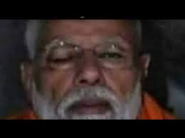 Curtain technique' by Dr. Deepak Dhingra 😅 feat. @vijetadahiya1 . . . . .  #dhruvrathee #dhruvratheeshorts #drshorts #reels #informative #education  #Mission100Crore