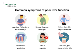 Image result for Liver Function Test