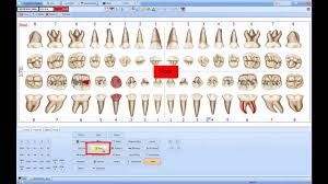 dental chart mp4 youtube