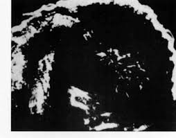 Prior to joining rothesay, graham was at willis towers watson and qualified as a fellow of the institute of actuaries in 2006. Tom Brown Ultrasound Pioneer