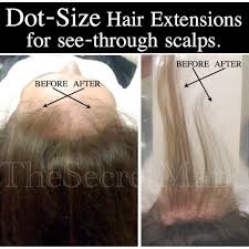 Clip in hair extensions and hair loss one very popular hair extension method is having the extensions clipped into the hair. Hair Extensions For Bald Spots Home Facebook