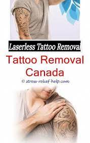 How Does Getting A Tattoo Removed Feel How To Remove Tattoos Gta Online How To Help Laser Tattoo Remova Tattoo Removal Cost Tattoo Removal Tattoo Removal Cream