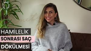 Hamilelik Sonrasi Sac Dokulmesi Ve Kullandigim Urunler Youtube