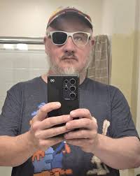 How can you survive with one eye …👁️ 📸: Jenisha Aggarwal