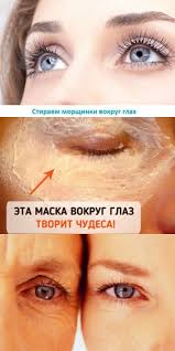 как избавиться от мешков под глазами в домашних условиях Stiraem Morshiny I Meshki Vokrug Glaz V 2020 G Zdorove Krasota Krem Dlya Kozhi Vokrug Glaz