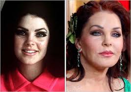 If you're not happy with the b. Celebrity Plastic Surgery What Not To Do The New York Times