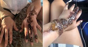 (you likely have seen henna used for semipermanent tattoos on hands and arms, like this rad look here.) three years ago, she realized she had an allergy to paraphenylenediamine, a chemical used in permanent hair dye. Australian Traveller S Gruesome Reaction To Henna Tattoo