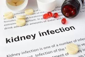 9 Amazing Home Remedies For Pyelonephritis Kidney Infection Relief Kidney Infection Causes Remedies For Kidney Infection Kidney Infection