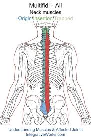Oit Multifidi Overlapped Trigger Points Trigger Point Therapy Massage Therapy