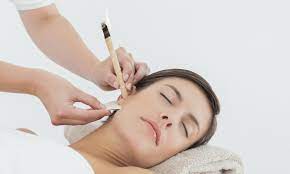 Hopi Ear Candle Candling At Cheshire Lasers Clinic In Middlewich