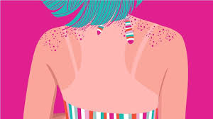 These cancers usually develop on areas exposed to the sun. Everything You Need To Know About Skin Cancer The Swaddle