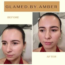 A pout so perfect, I'm speechless 🫦 swipe to see her before pictures ➡️  @idealimage . . Product: Juvederm Ultra, 1.0 ml Purpose: This client wanted  a little more volume in her